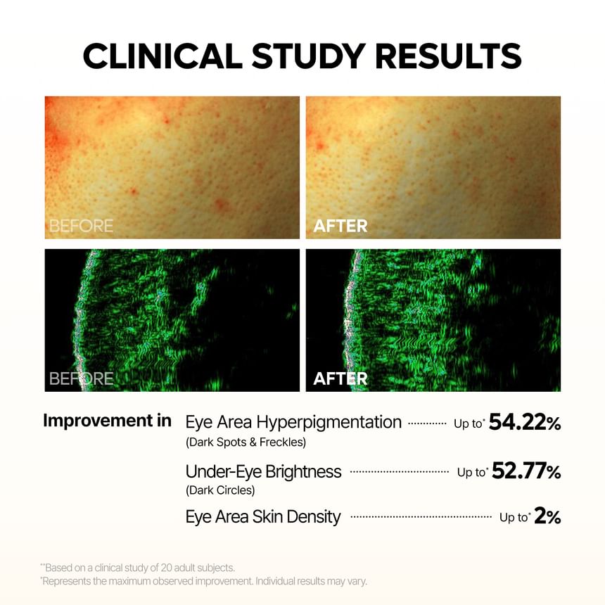 Dr.Melaxin - TX-Kojic Acid Retinal Eye Patch [60 patches]