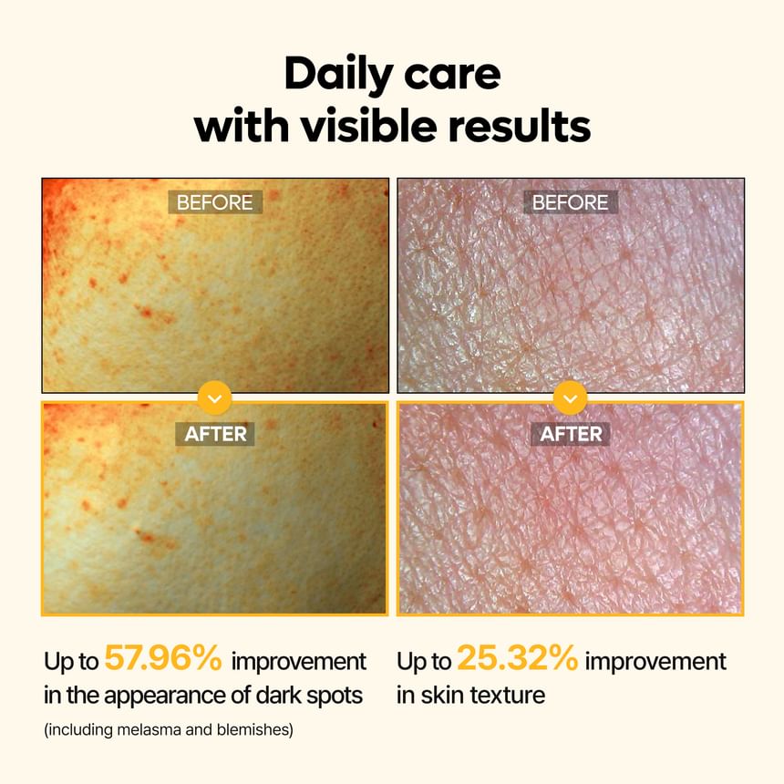 Dr.Melaxin - Kojic Acid Turmeric Toner [200ml]