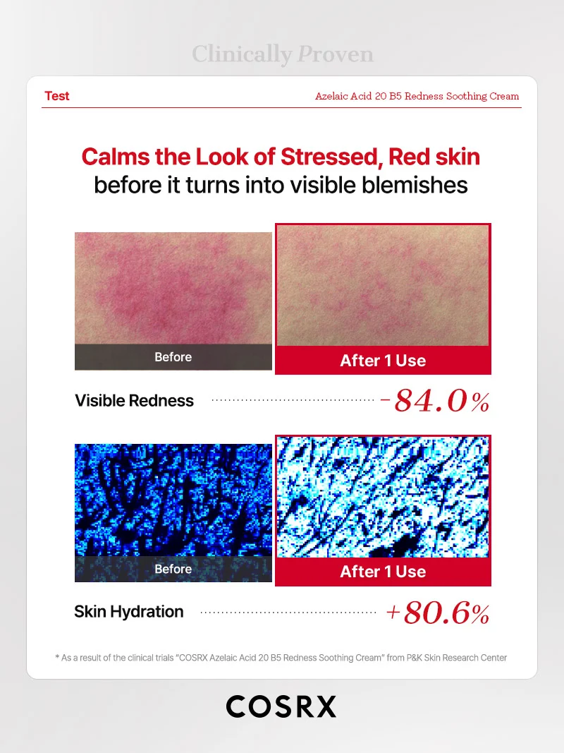 COSRX - Azelaic Acid 20 B5 Redness Soothing Cream (30ml)
