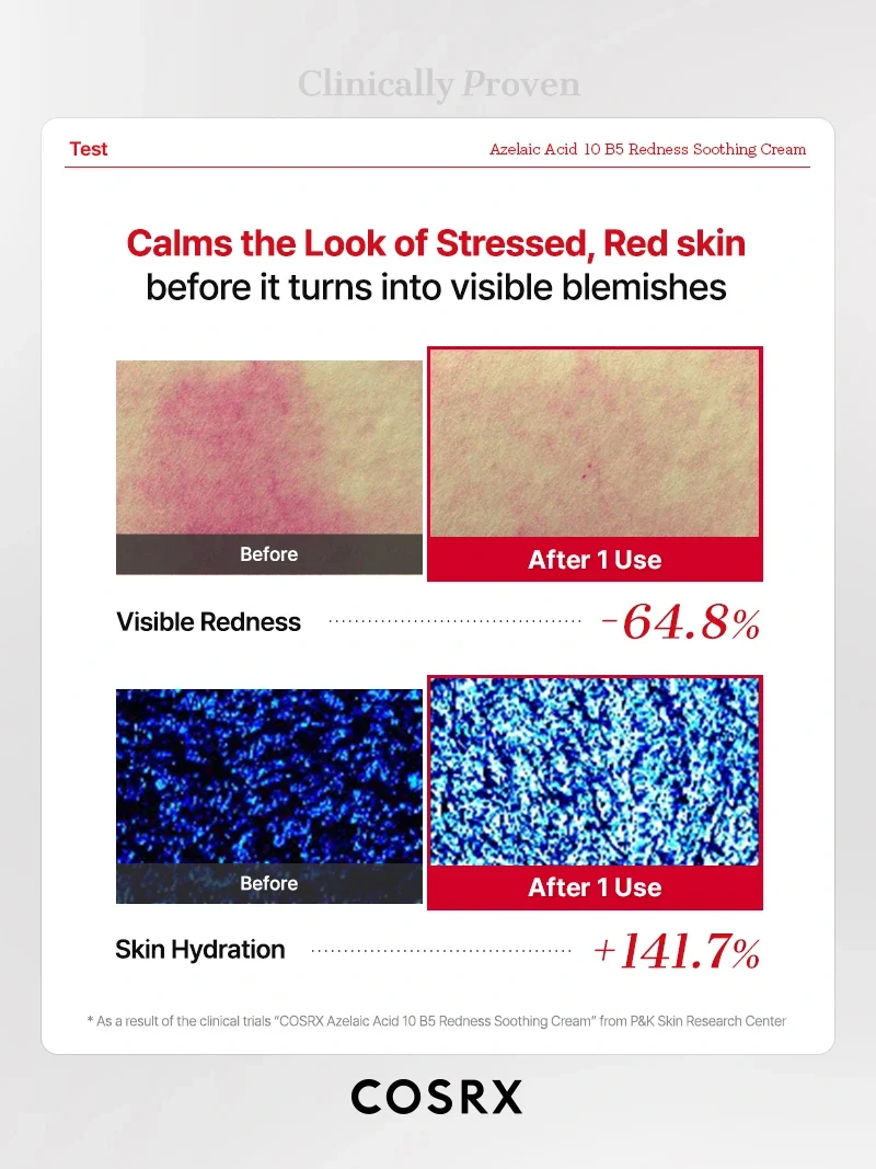 COSRX - Azelaic Acid 10 B5 Redness Soothing Cream (30ml)