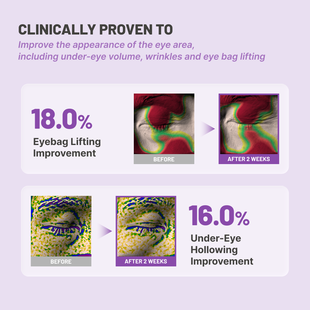Jumiso - Niacinamide 5+ Depuffing Under-Eye Patches (5 Pairs)