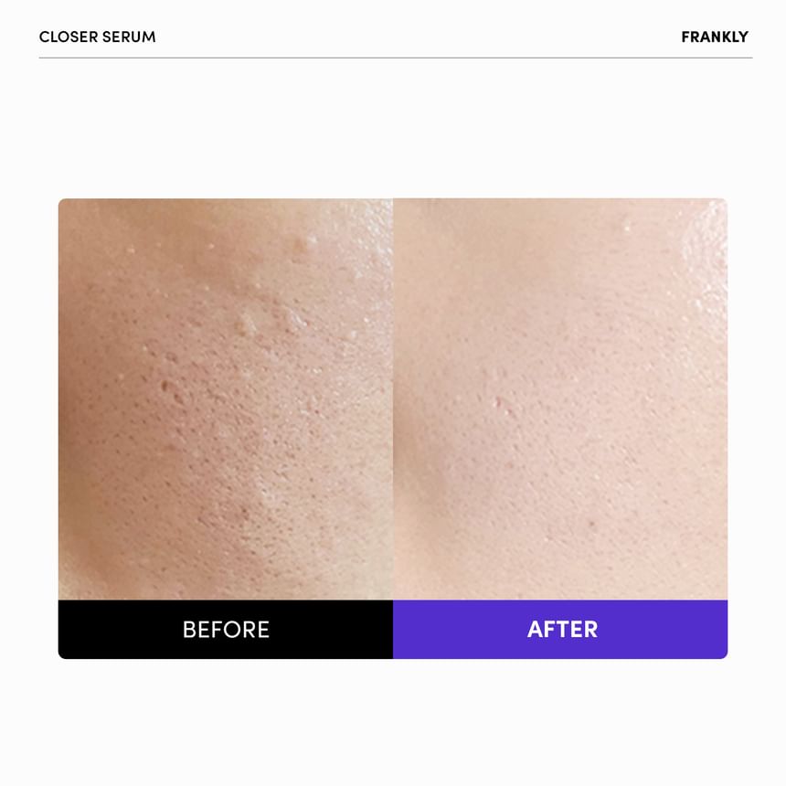 Frankly - Closer Serum [100ml]