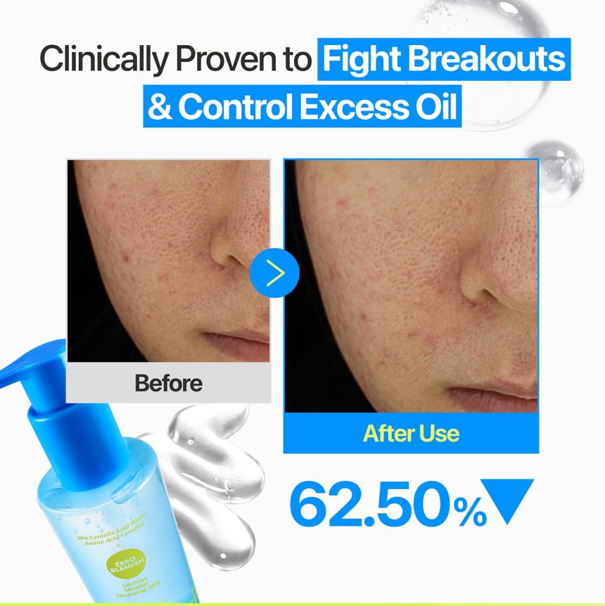Numbuzin - No.0 Zero Blemish Oil-Free Micellar Cleansing Jelly [200ml]