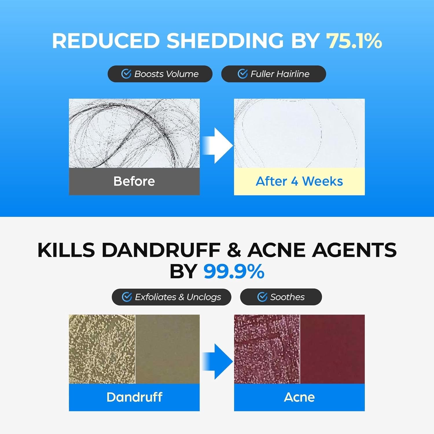 Seapuri - Scalpy Bubble Tonic [100ml]