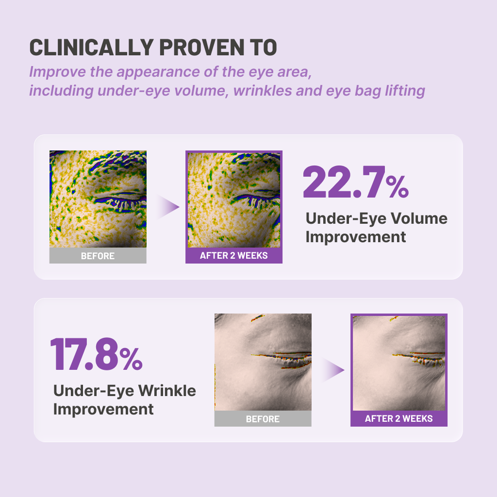 Jumiso - Niacinamide 5+ Depuffing Under-Eye Patches (5 Pairs)