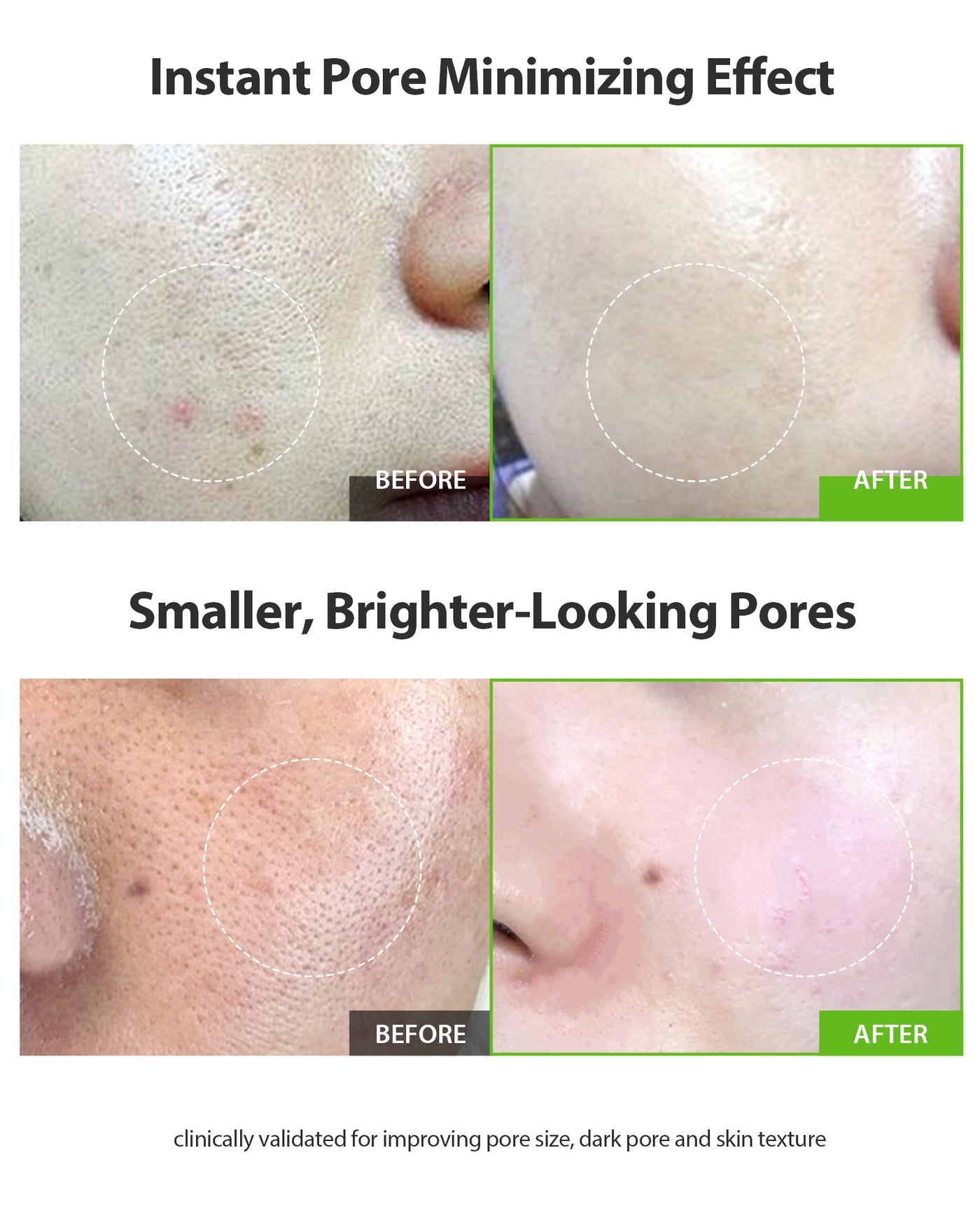 Sungboon Editor - Green Tomato Pore Lifting Ampoule+ [30ml]