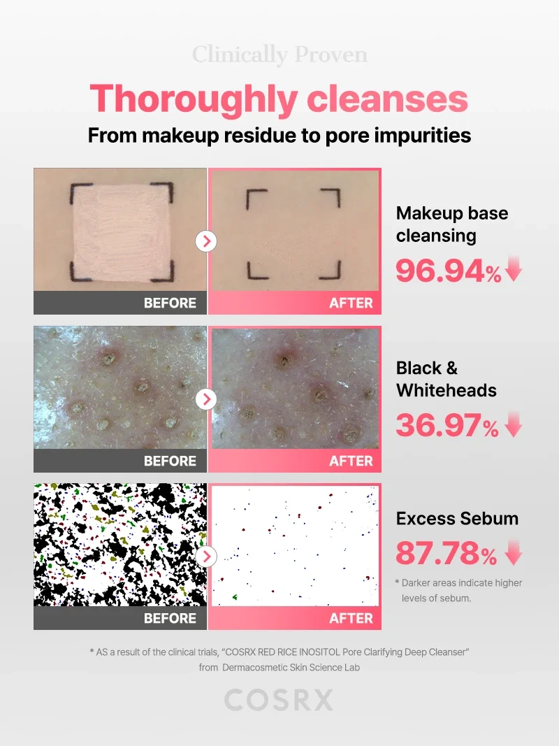 COSRX - Red Rice Inositol Pore Clarifying Deep Cleanser (150ml)