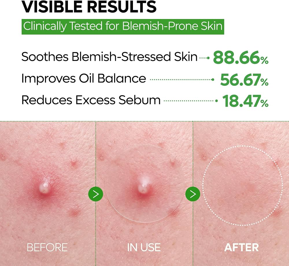 Dr.Melaxin - S-Zinc Zero-Fit Ultra Thin Blemish Spot Patch (72 Patches)