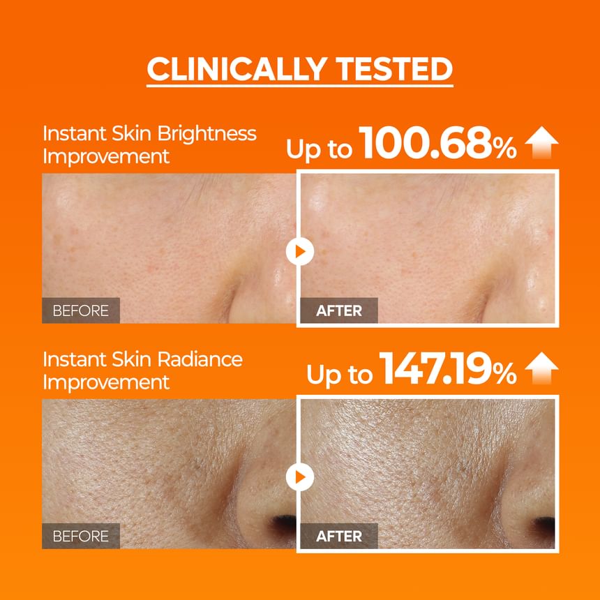 Dr.Melaxin - Peel Shot Exfoliating Mela-CE Ferulic Serum [80ml]