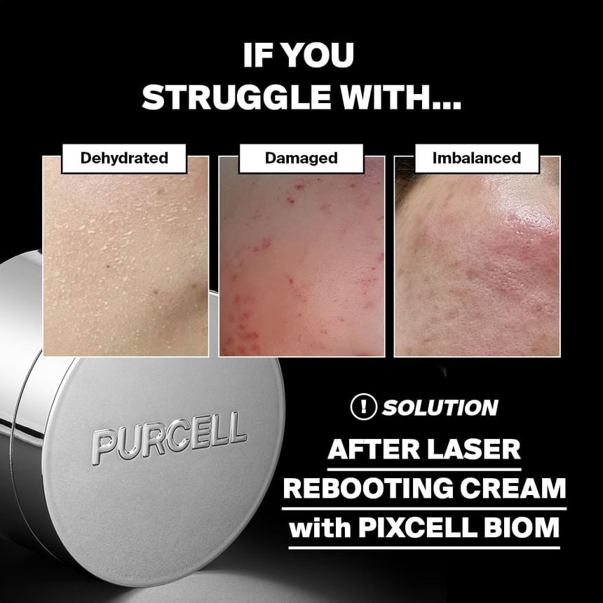 Purcell - (Renew) Pixcell Biom 5+ Probiotics Rebooting Cream [50ml]