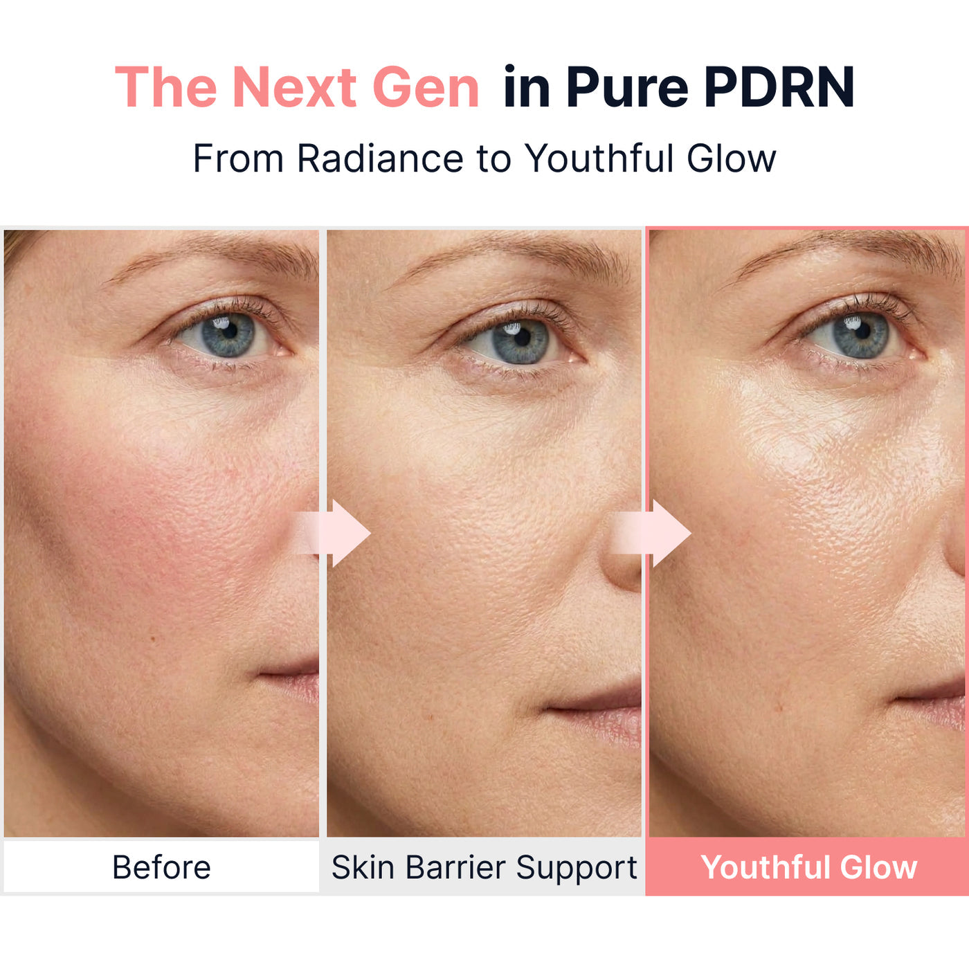 Sungboon Editor - PDRN Pink Vitamin Glow Boosting Ampoule [40ml]