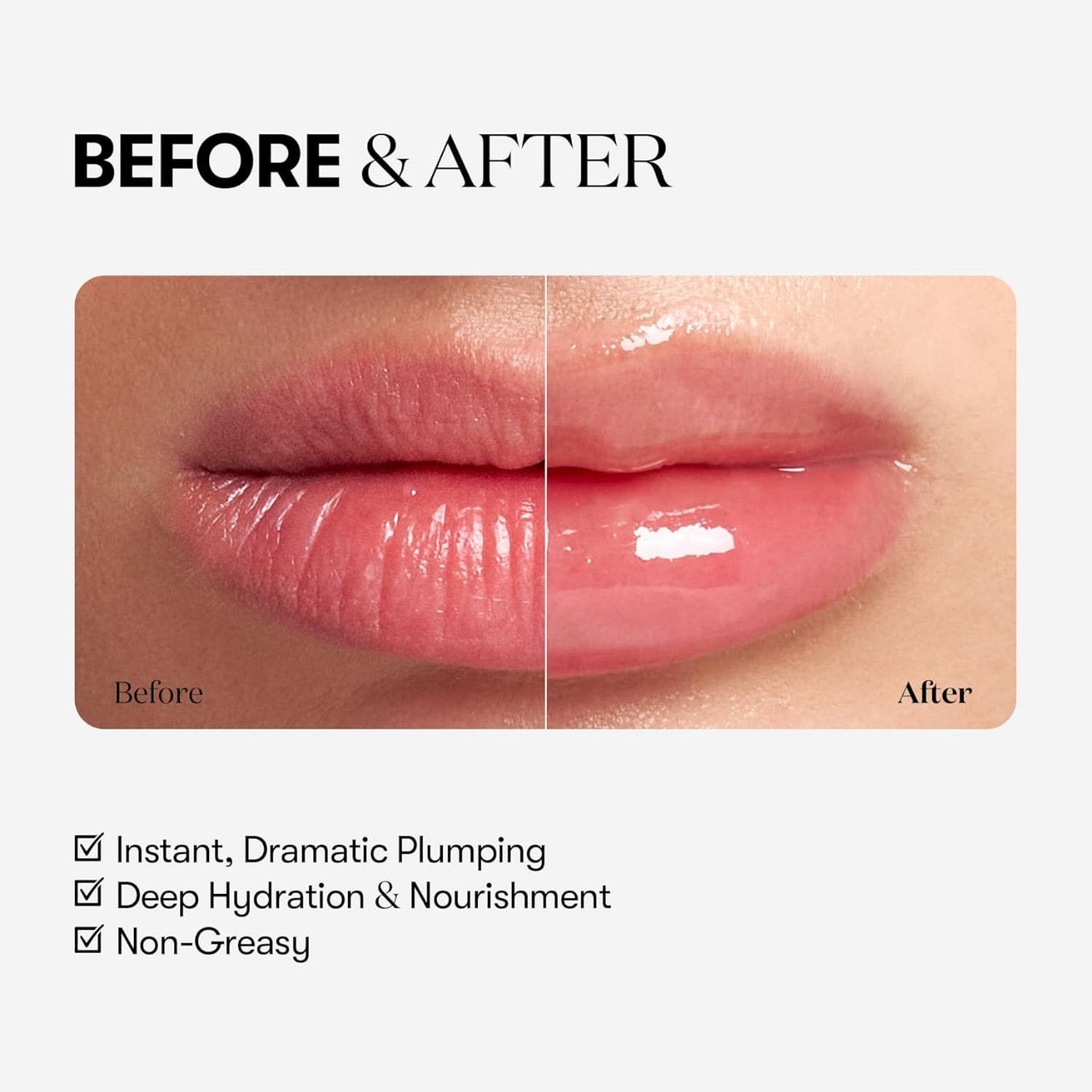 VT - Reedle Shot Lip Plumper Expert [4.3g]