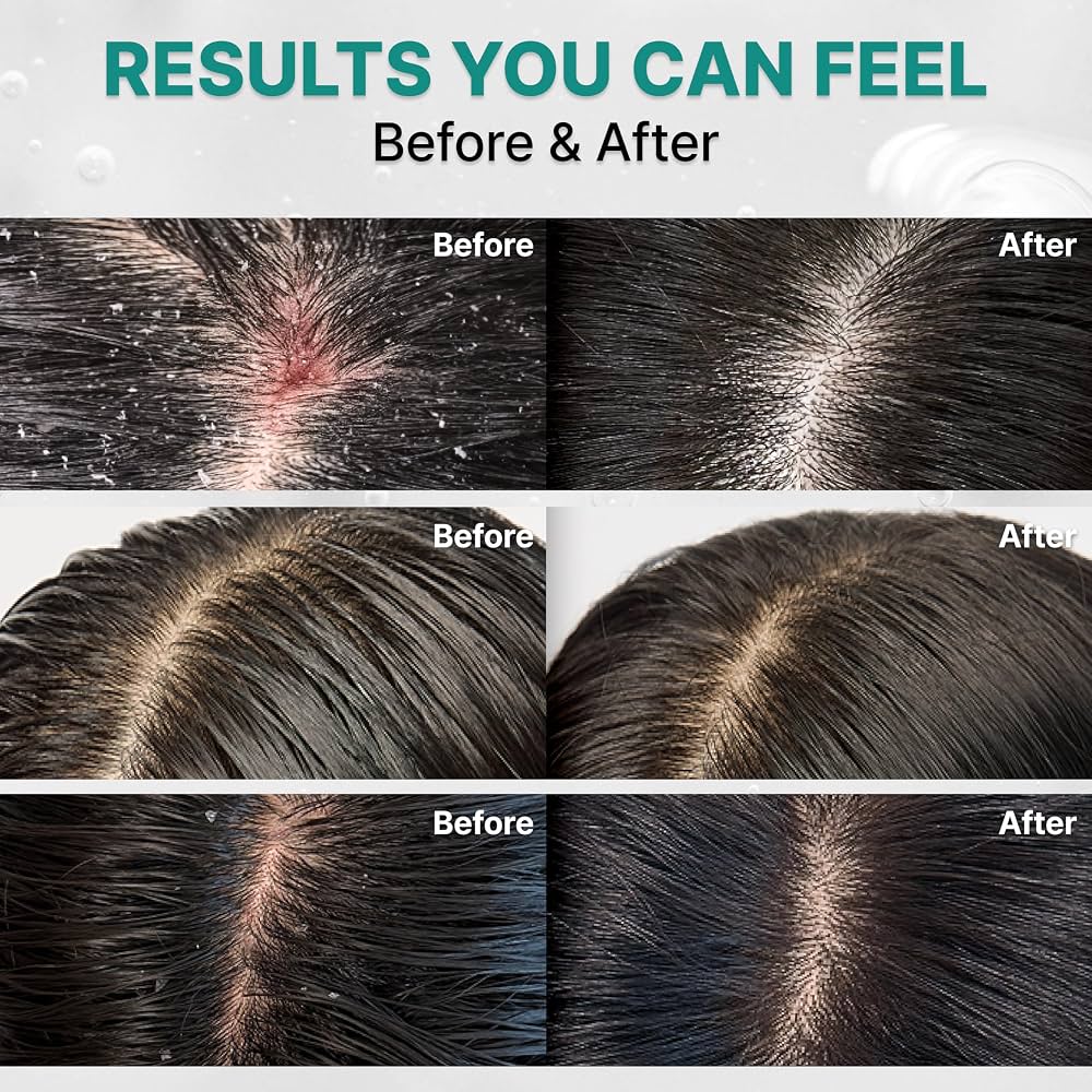 lilyeve - Scalp:Turn Cica PDRN Deep Clean Shampoo [500ml]