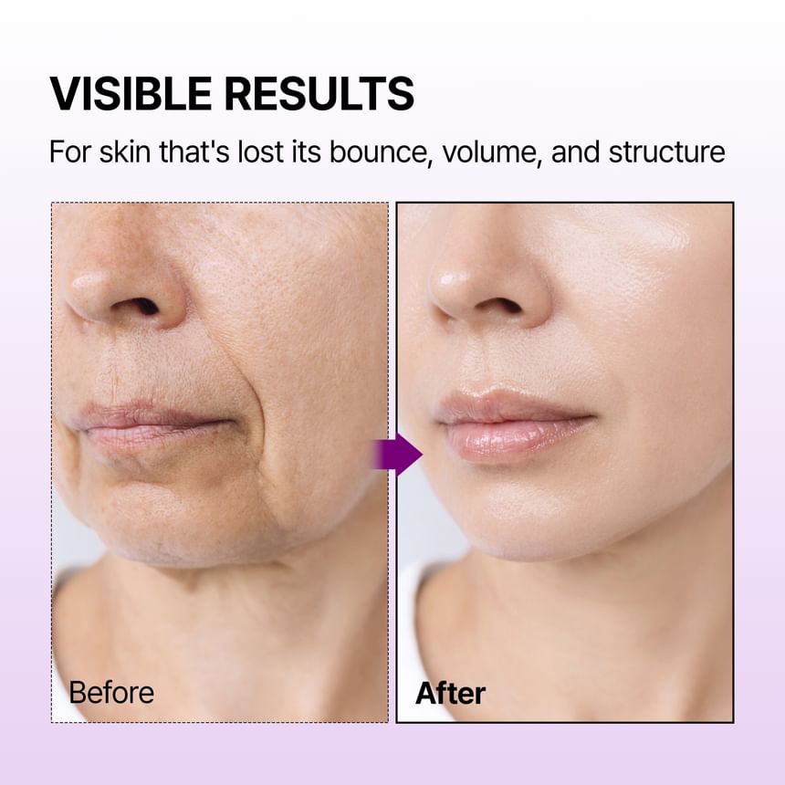 Dr.Melaxin - Calcium Bonding Facial Cream [100g]