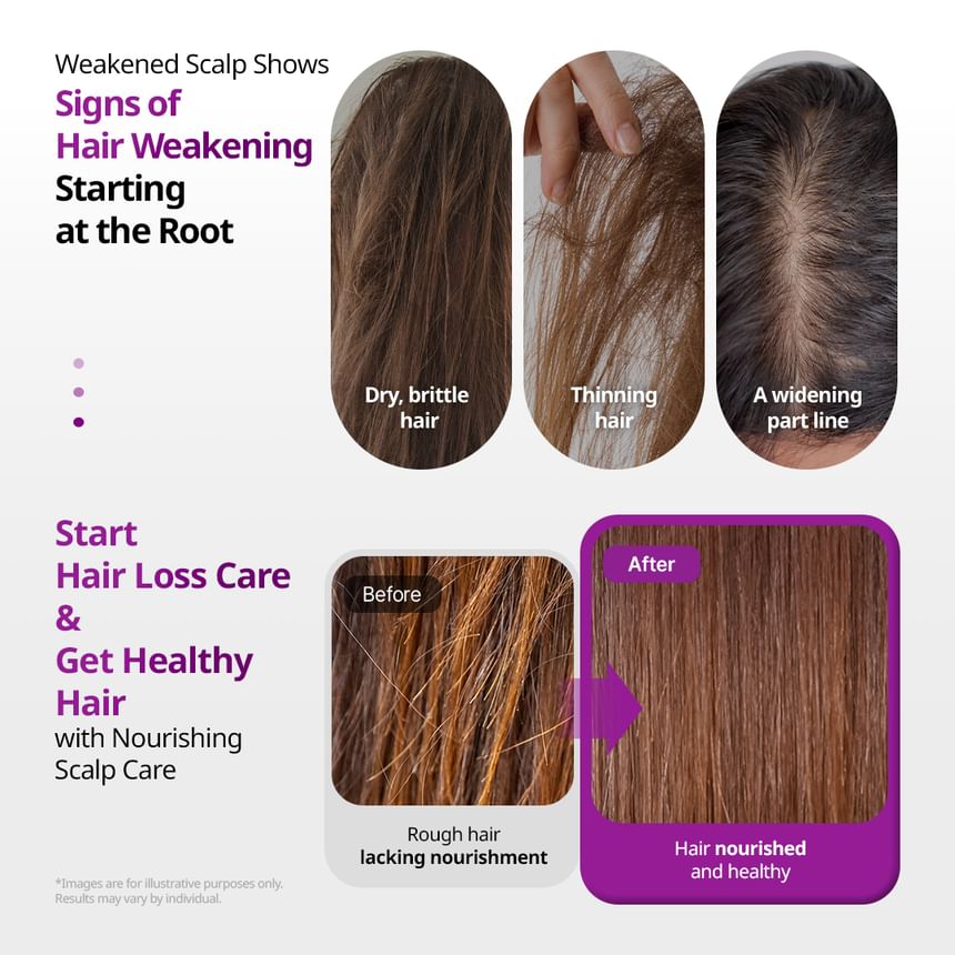 VT - Reedle Shot Hair Boosting Scalp Pack [250ml]
