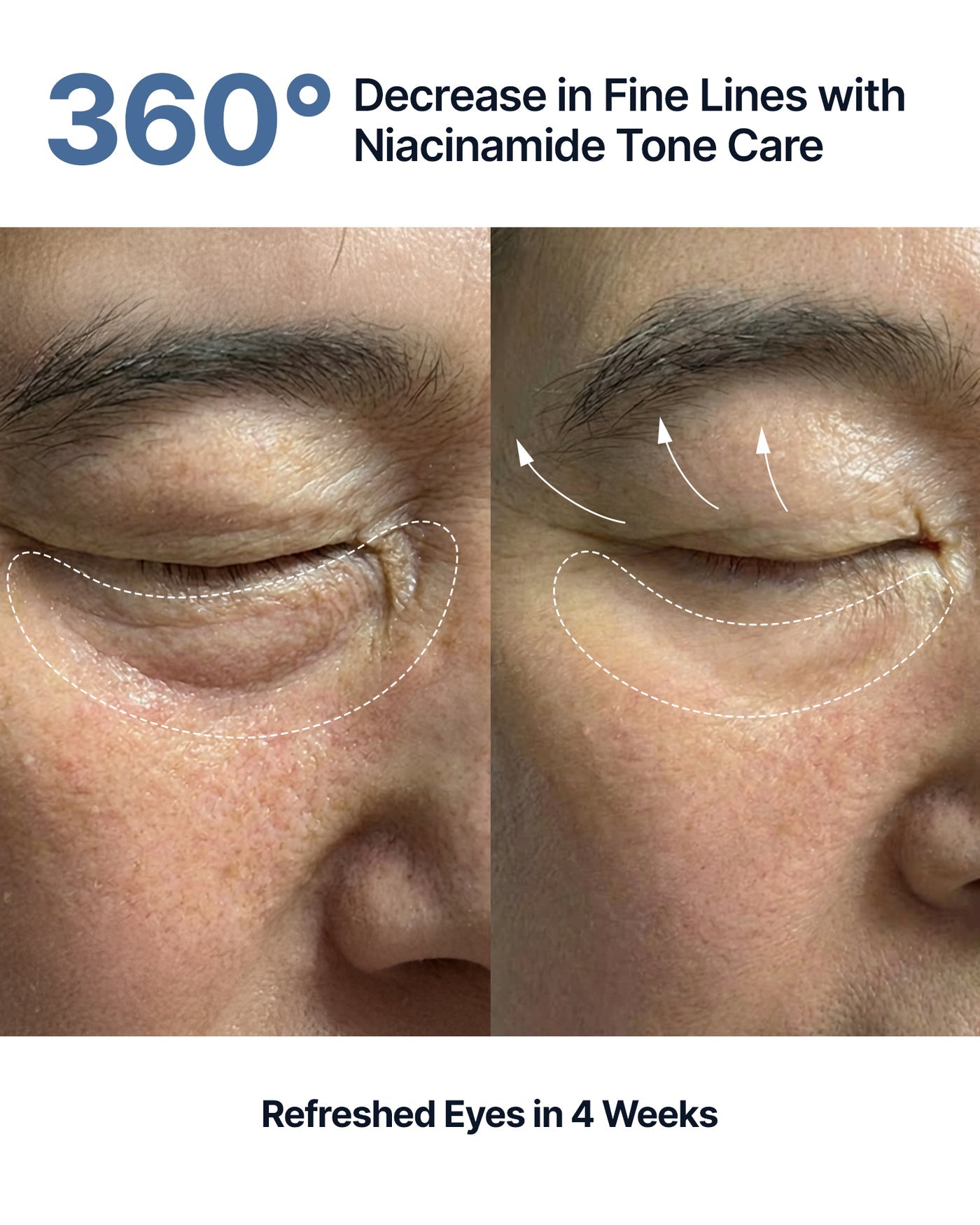 Sungboon Editor - Silk Peptide EGF Intensive Eye Cream [30ml]