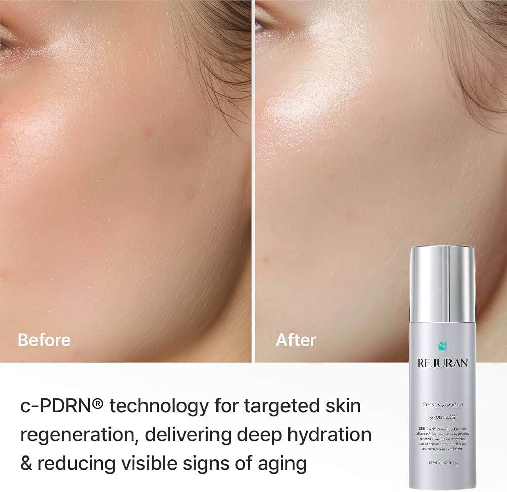 Rejuran - Refreshing Emulsion [45ml]