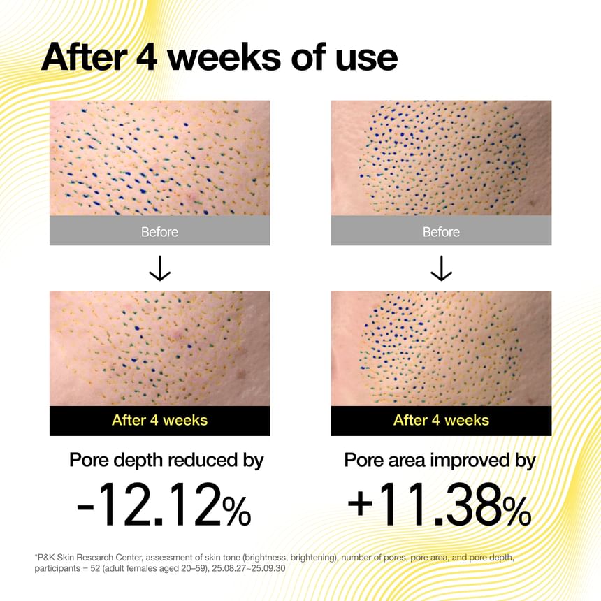 Anua - [KDH] Vita C Porestrix Brightening Serum Mask [1EA]