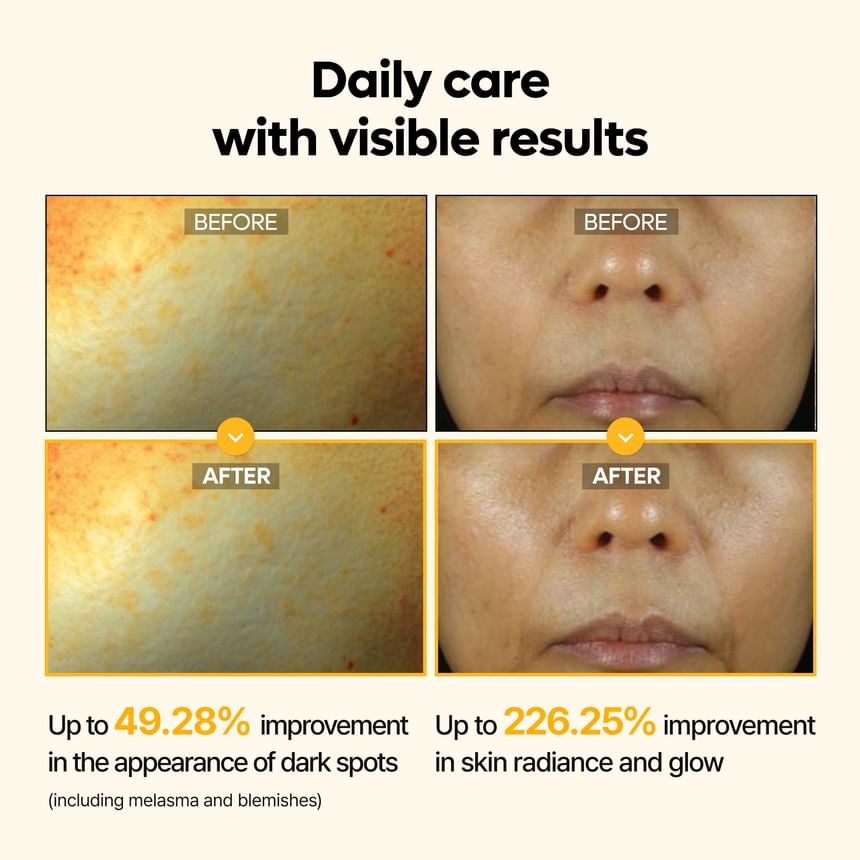 Dr.Melaxin - Kojic Acid Turmeric Serum [50ml]