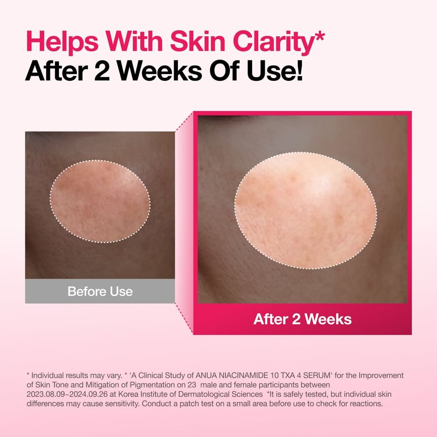 Anua - [KDH] Niacinamide 10 TXA 4 Serum (50ml)