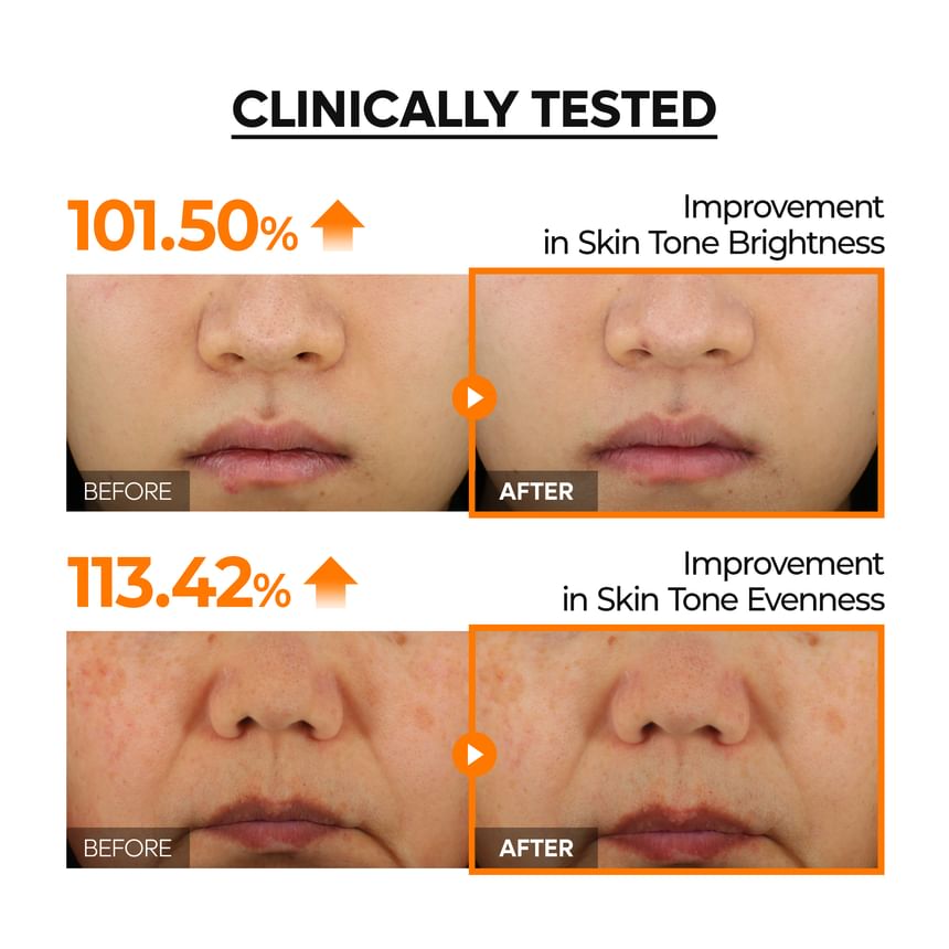 Dr.Melaxin - Mela-CE Ferulic Serum (50ml)