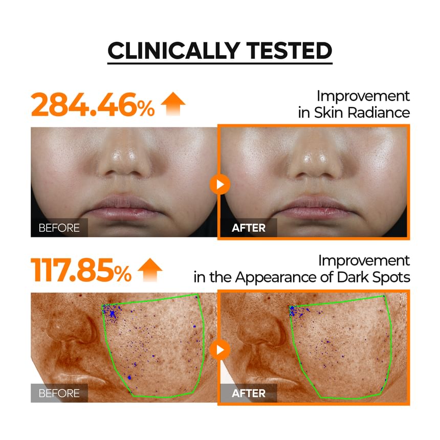 Dr.Melaxin - Mela-CE Ferulic Serum (50ml)