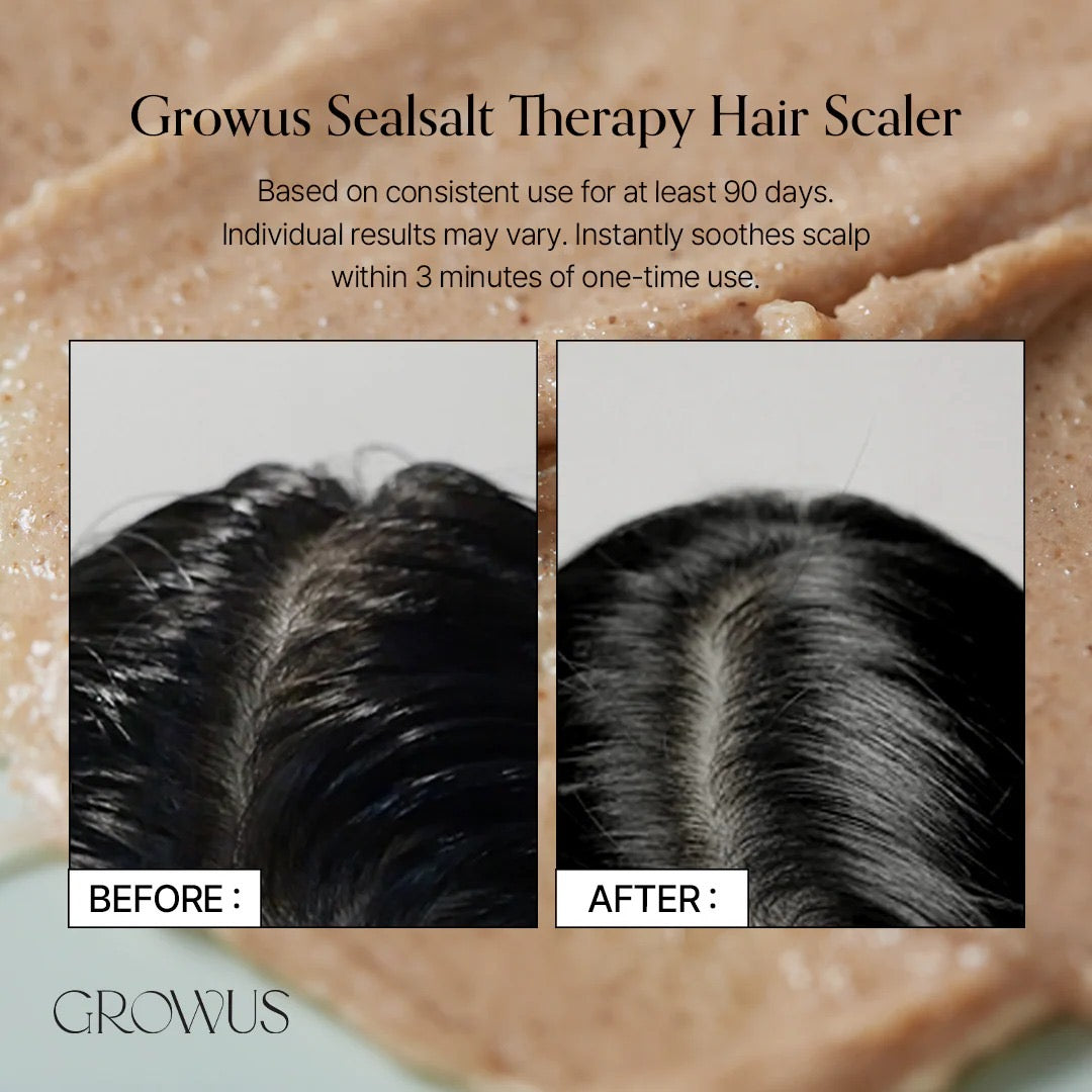 GROWUS - Sea Salt Therapy Scalp Scaler [250g]