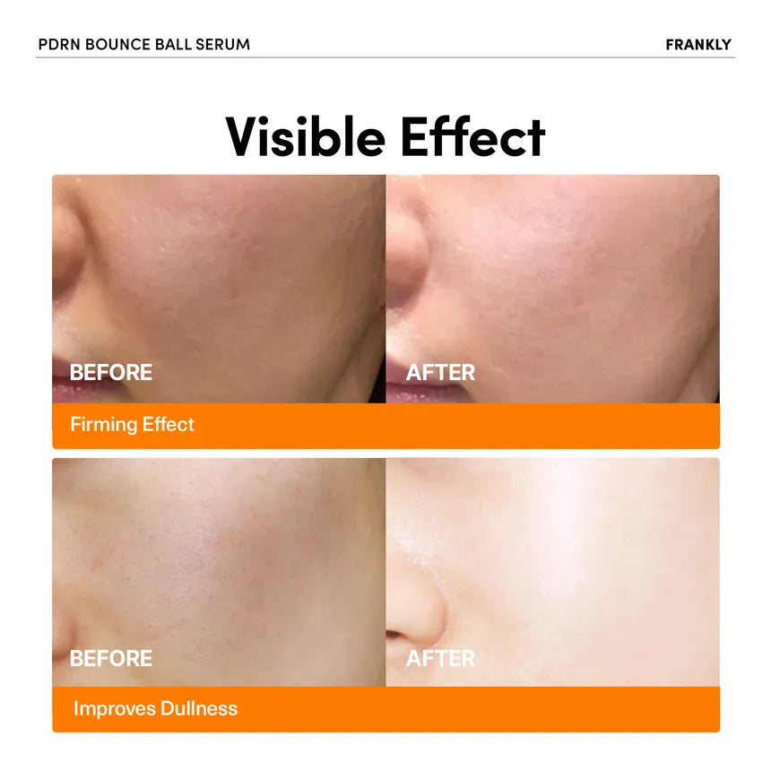 Frankly - PDRN Bounce Ball Serum [30ml]