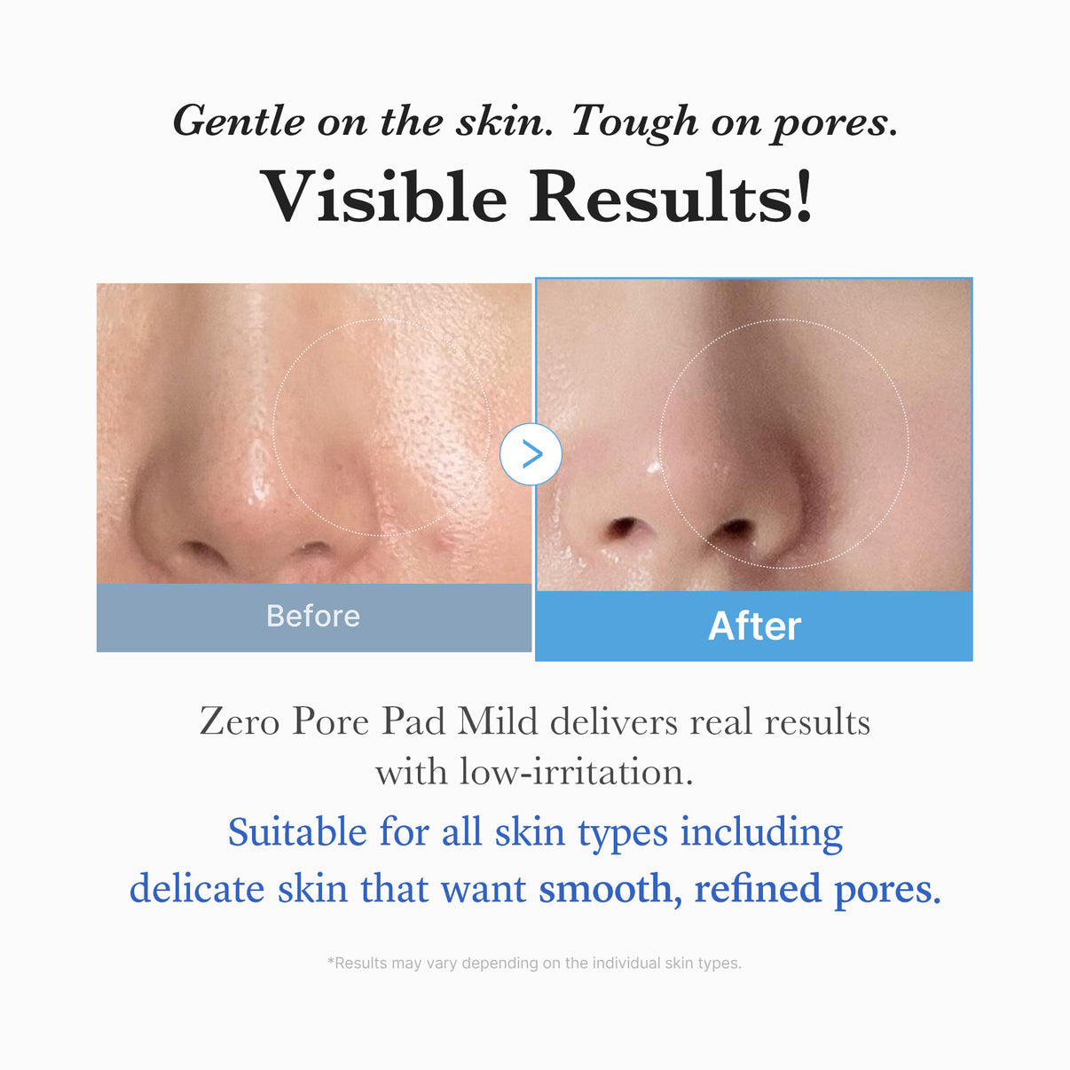 Medicube - Zero Pore Pad Mild [70pcs]