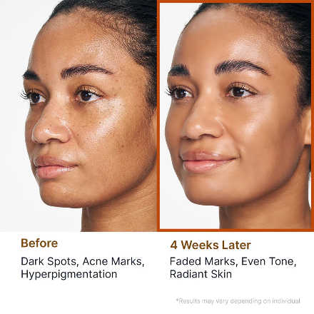 Sungboon Editor - Kojic Acid Niacinamide Radiance Soothing Gel Cleanser [120g]