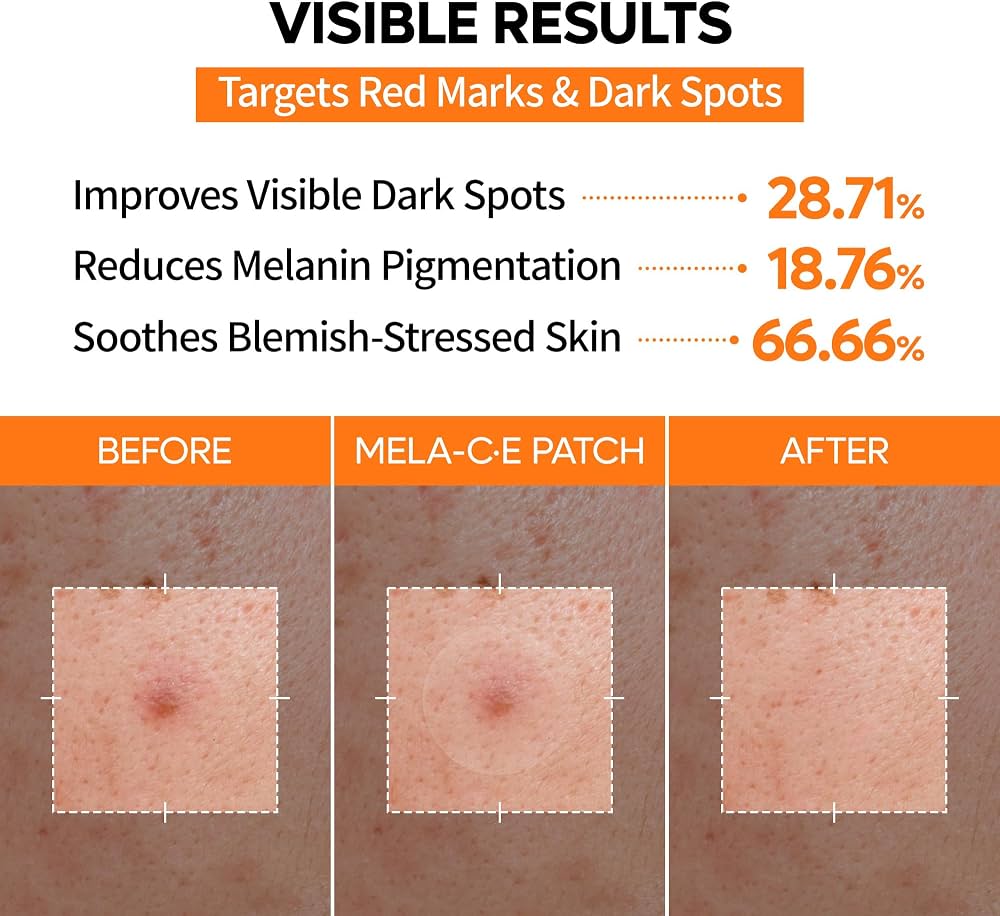 Dr.Melaxin - Mela-CE Zero-Fit Ultra Thin Dark Spot Patch (72 patches)