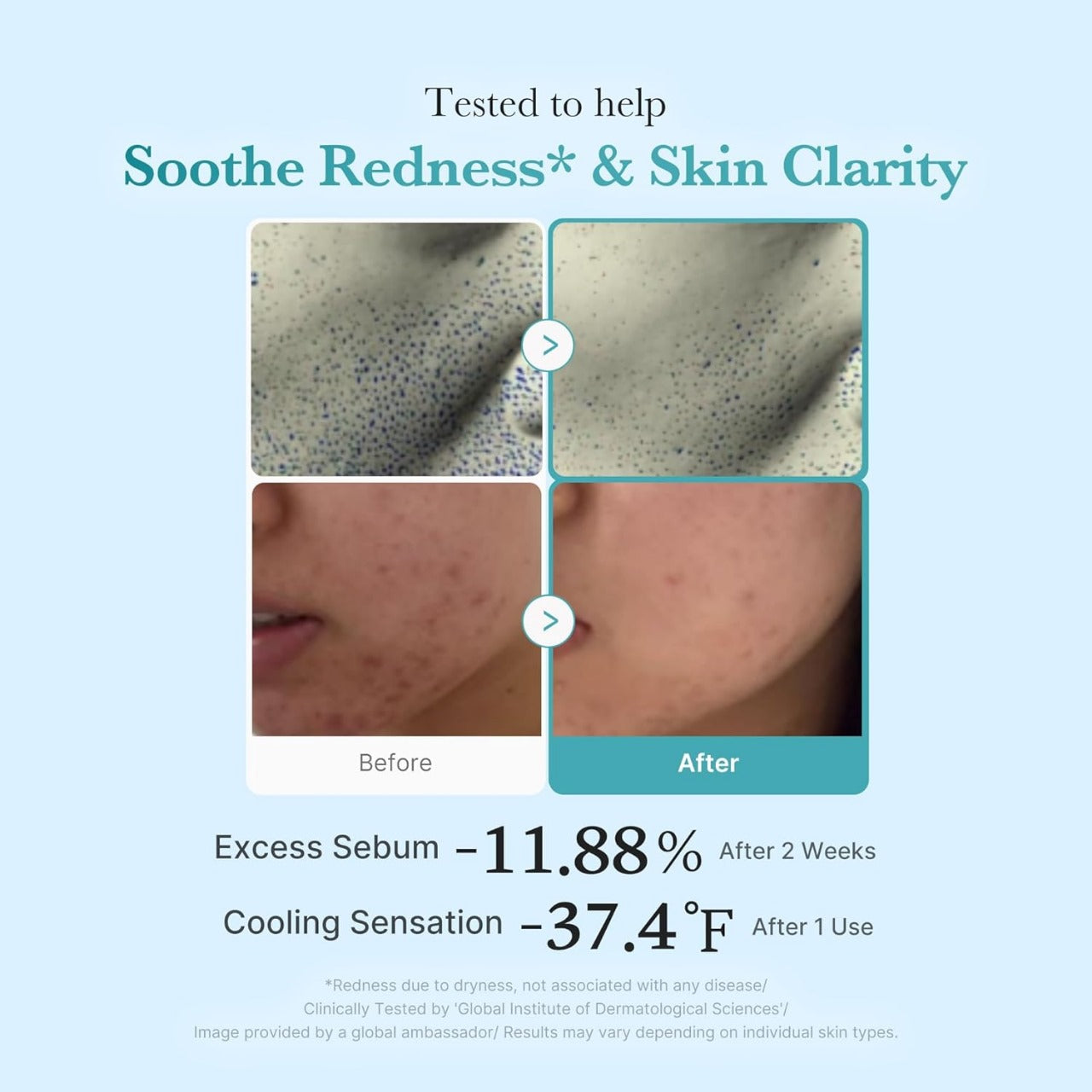 Medicube - Azelaic Acid Niacinamide Clear Toner [250ml]