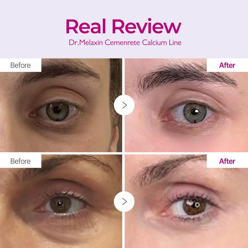 Dr.Melaxin - Cemenrete Calcium Volume Cream [50ml]