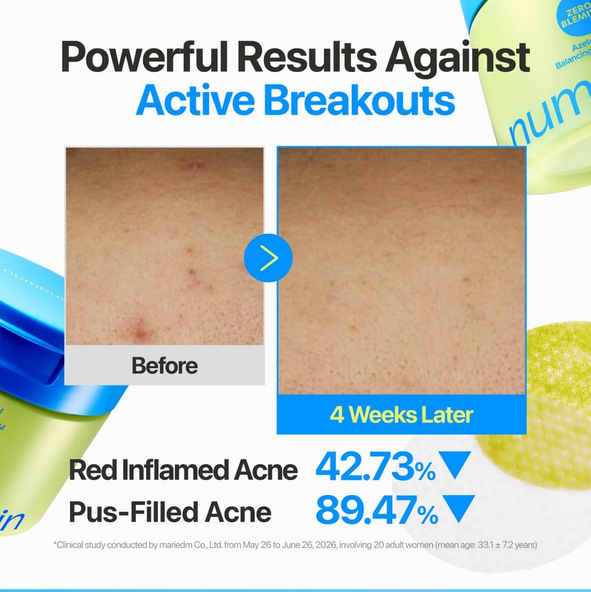 Numbuzin - No.0 Zero Blemish Azela Cica Balancing Dual Pads [210ml, 60 pads]