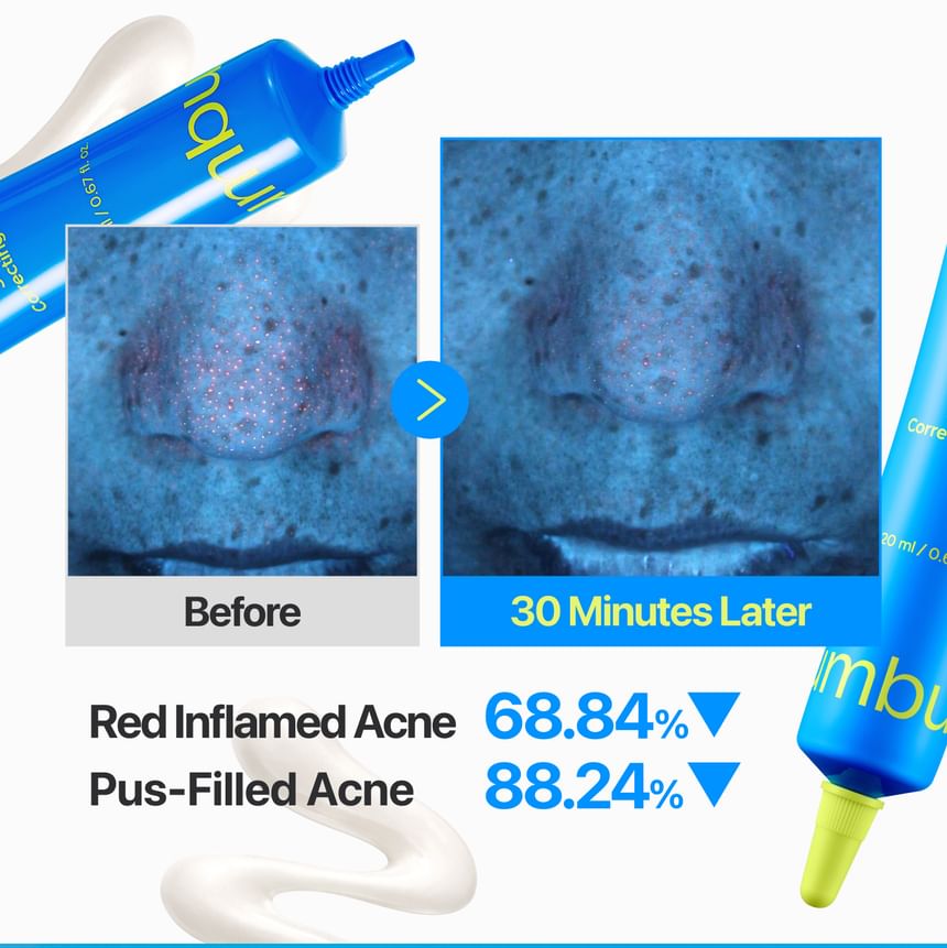 Numbuzin - No.0 Zero Blemish 3X Spot Correcting Cream [20ml]
