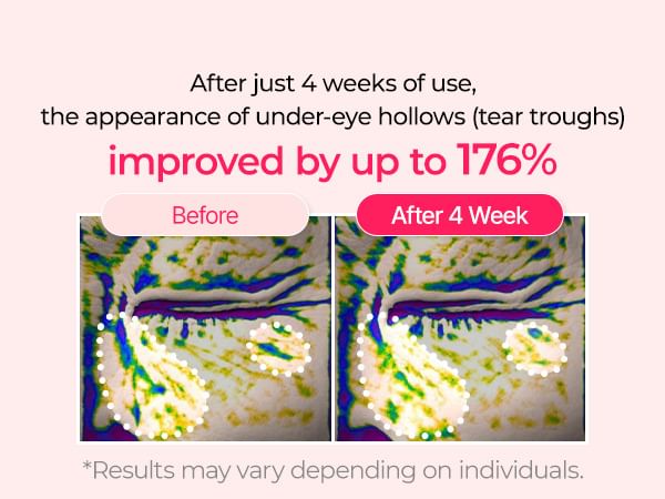 Dr.Melaxin - Cemenrete Cyano Pink Spicule Cream [50g]