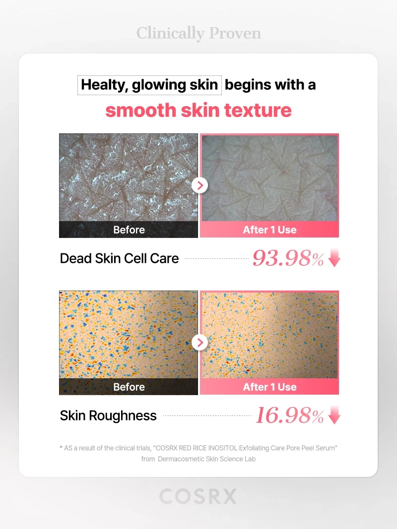 COSRX - Red Rice Inositol Exfoliating Care Pore Peel Serum (80ml)