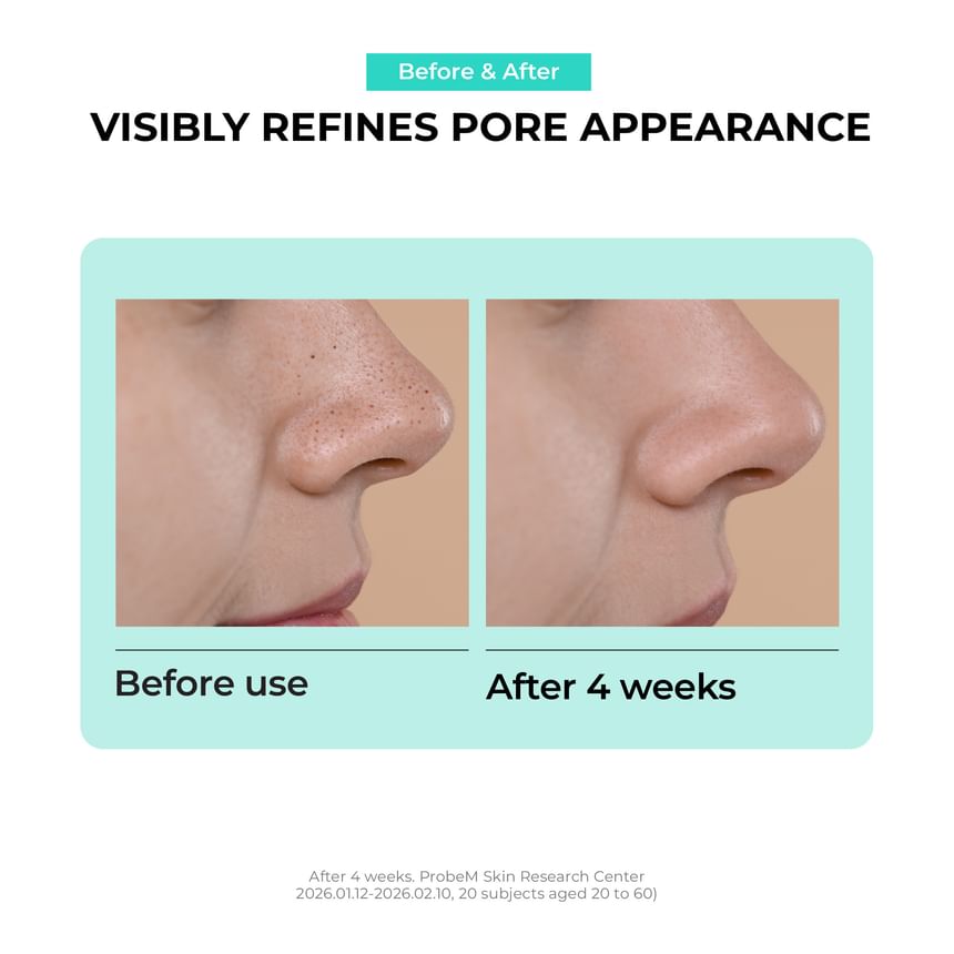 JUMISO - Overnight Zero Pore Nose Patch Set (10 Patches)
