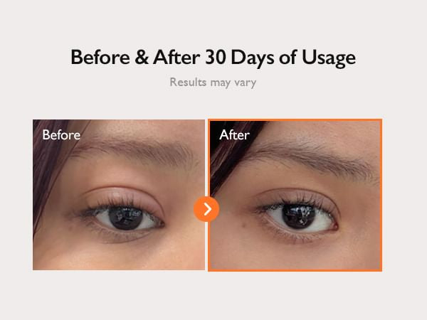 Genabelle - PDRN 360 Rejuvenating Eye Mask [70ea, 100ml]