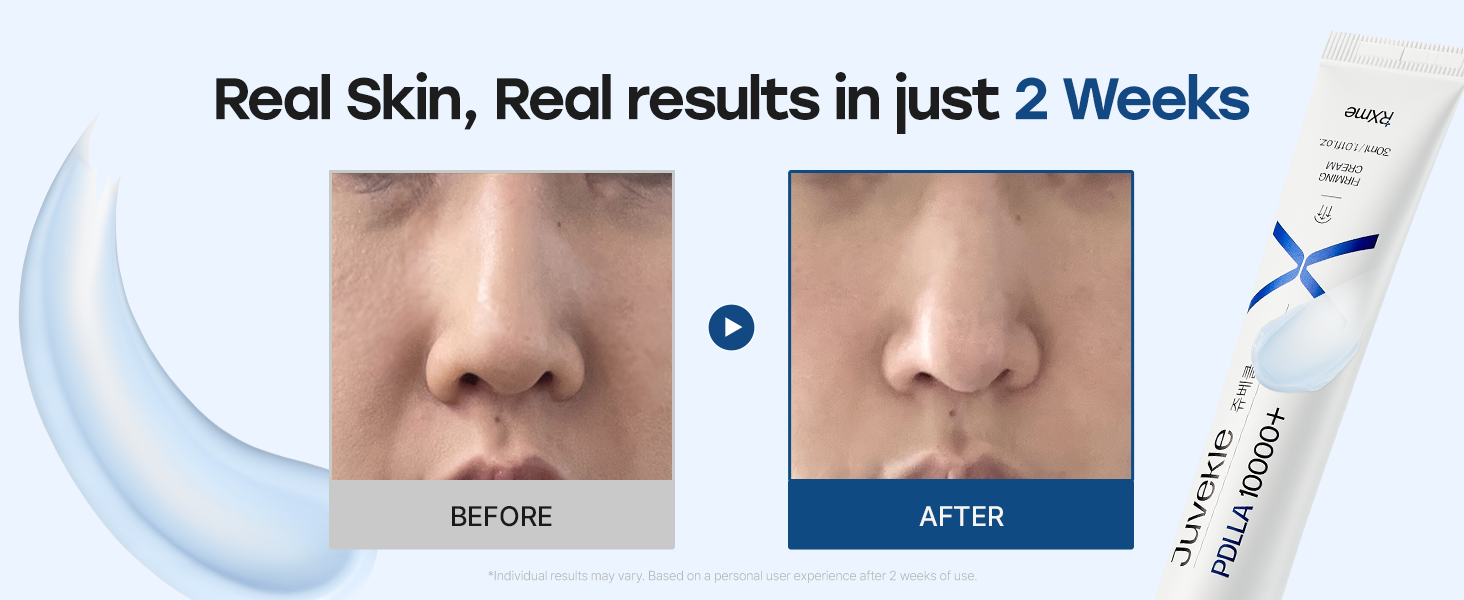 RXme - Juvekle Ultra PDLLA 10000 Plus Firming Cream [20ml]