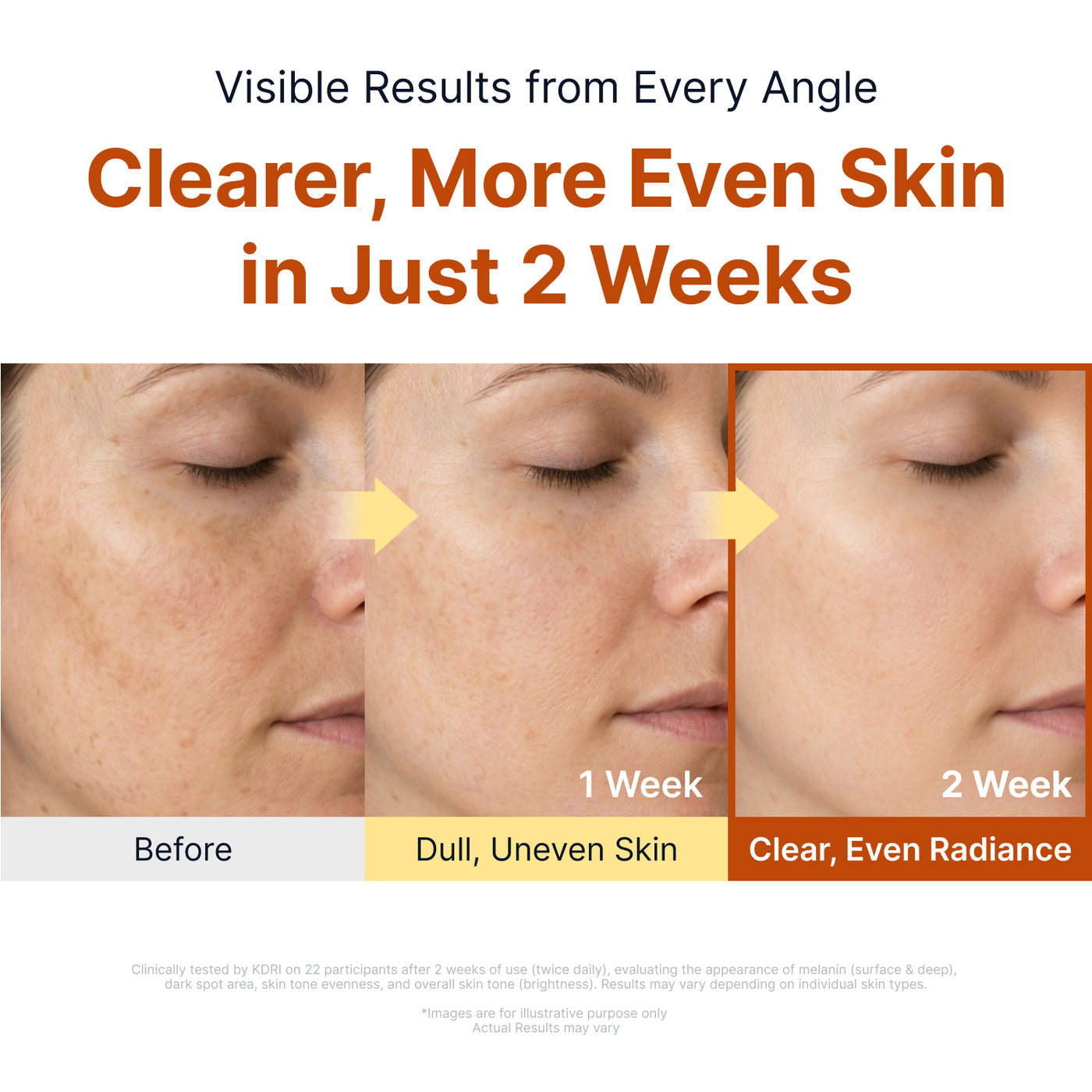 Sungboon Editor - Kojic Acid Niacinamide Brightening Ampoule [40ml]