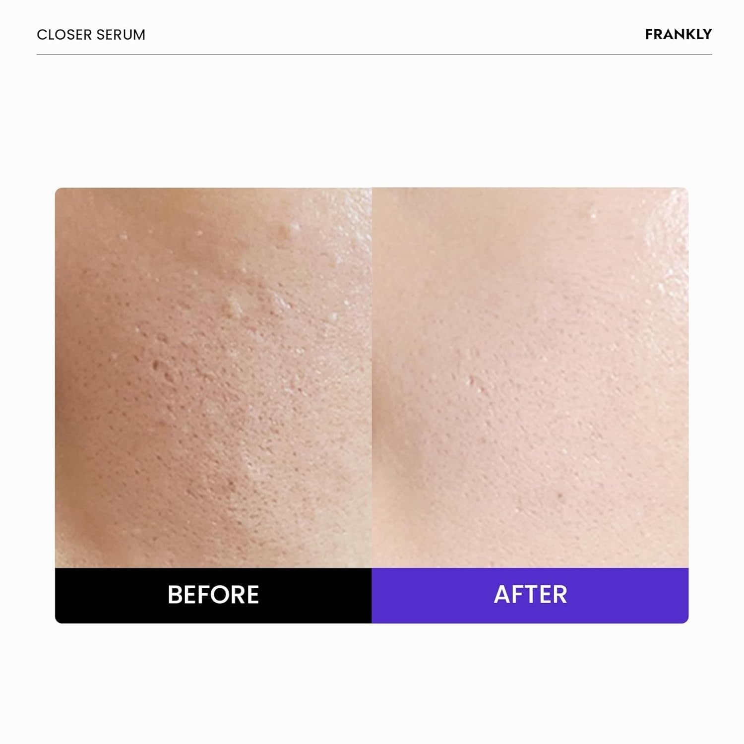 FRANKLY - Closer Serum [60ml]