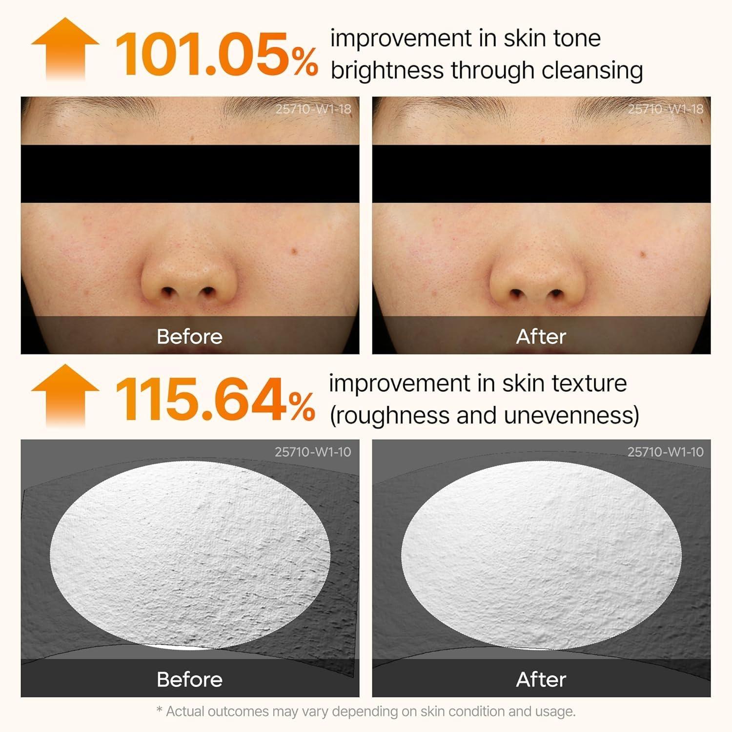 Dr.Melaxin - Peel Shot Exfoliating Kojic Acid Turmeric Serum [80ml]