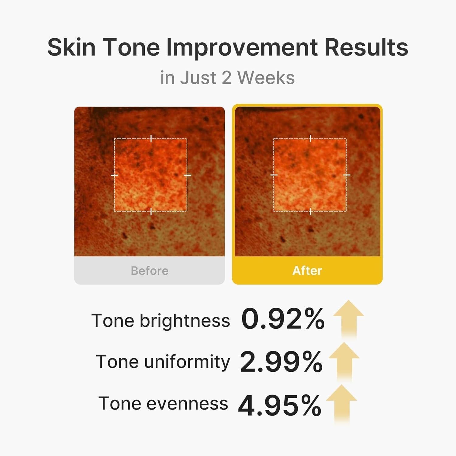 Medicube - Kojic Acid Turmeric Vita Capsule Cream [53g]